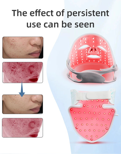 LED Red Light Therapy Face Mask & Neck Set